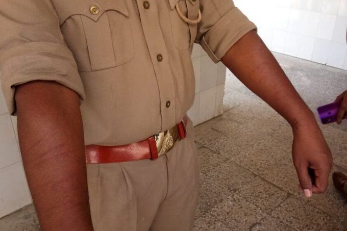 यूपी के कानपुर में Lockdown का उल्लंघन करने से रोकने पर हमला, एक दरोगा समेत 3 सिपाही घायल यूपी के कानपुर में Lockdown का उल्लंघन करने से रोकने पर हमला, एक दरोगा समेत 3 सिपाही घायल