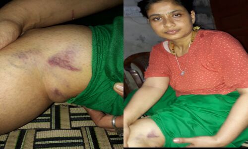 यूपी के गाजियाबाद में महिला आईएएस रानी नागर के सामने उसकी सगी बहन को बुरी तरह पीटा यूपी के गाजियाबाद में महिला आईएएस रानी नागर के सामने उसकी सगी बहन को बुरी तरह पीटा