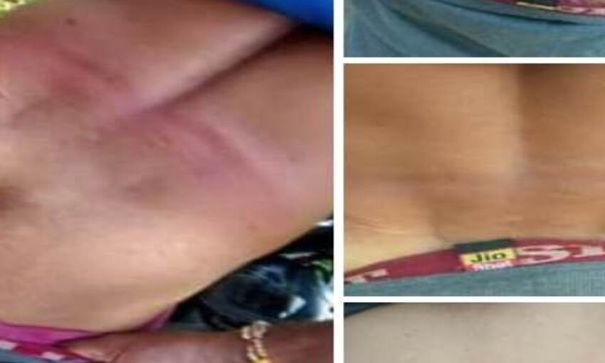 बाराबंकी में जब पंडितजी पर चला यूपी पुलिस का हंटर, सामने आई खौफनाक तस्वीर बाराबंकी में जब पंडितजी पर चला यूपी पुलिस का हंटर, सामने आई खौफनाक तस्वीर