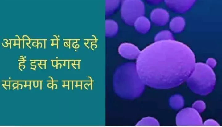 यूएस में आई नई बीमारी, यूएस के लोग हो गए चिंता में, जानिए कौन सी है यह बीमारी और क्या है इससे बचने के उपाय ??