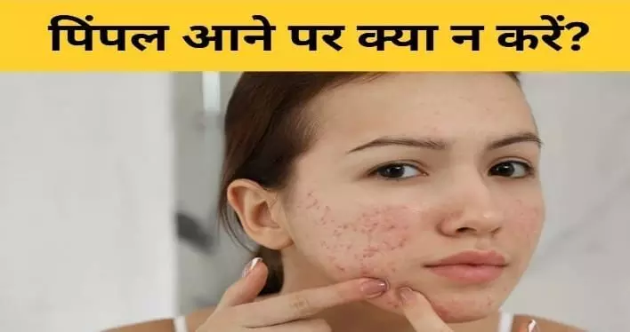 Pimples: अगर आपके भी चेहरे पर आते हैं मुंहासे तो ना करें यह गलतियां वरना बिगड़ जाएगा  फिर