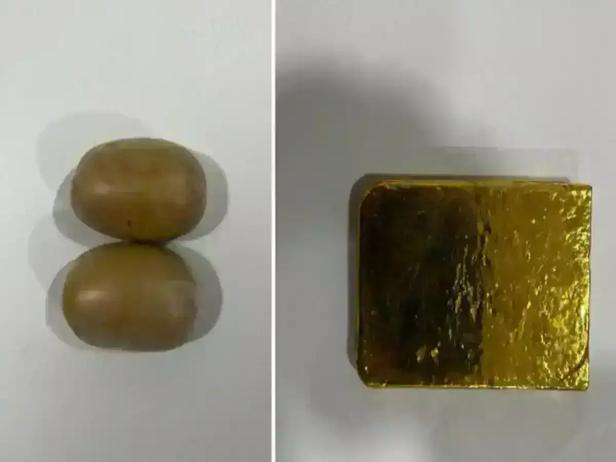 He brought gold worth Rs 38 lakh from UAE to India by hiding it in his stomach. Know how the young man was caught.