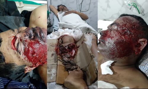 पूर्णिया में गैंगवार: कुख्यात बुच्चन यादव पर बम गोली से हमला, महिला की मौत कई घायल